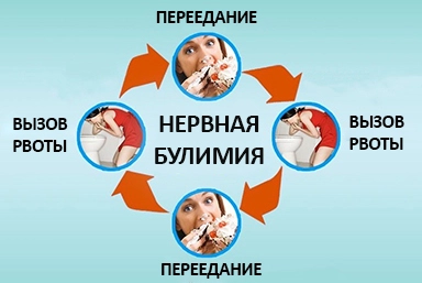 Лечение булимии в Великих Луках